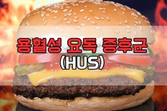 안산 유치원생 99명 식중독...‘햄버거병’ 의심