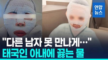 “다른 남자 만날까 봐”…태국인 아내 얼굴에 끓는 물 부은 40대 검거