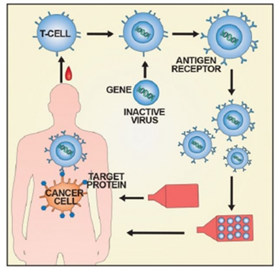 '혈액암 환자의 희망' T세포 항암제 '킴리아주' 국내 허가