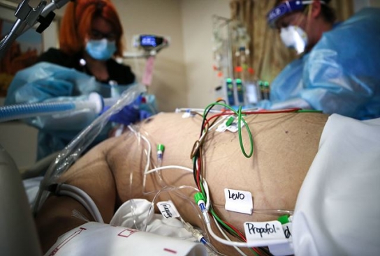 코로나 장기후유증으로 사망 의심사례 120건 확보